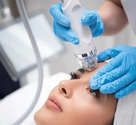 needlingfacial